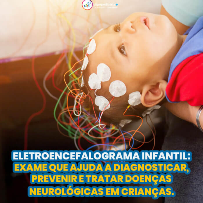 Eletroencefalograma infantil