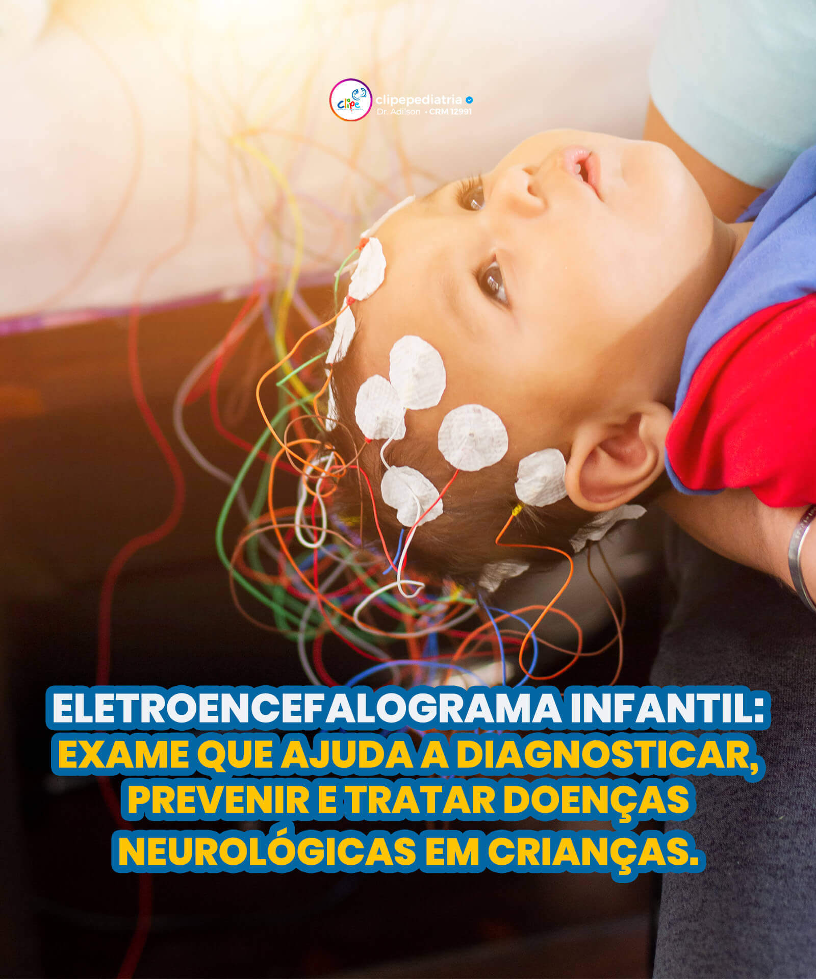 Eletroencefalograma infantil